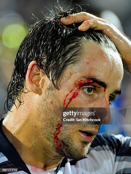 Cooper Cronk of the Storm bleeds from a head wound during the round eight NRL match between the North Queensland Cowboys and the Melbourne Storm at...