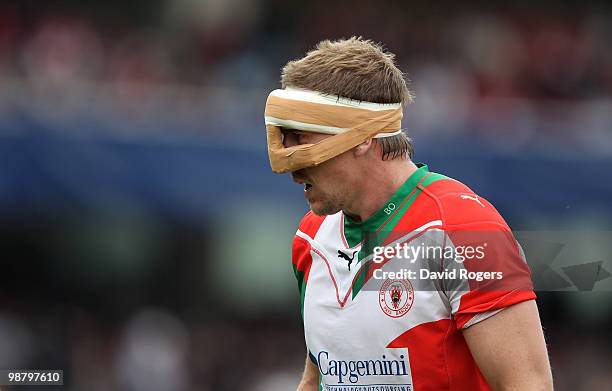 Imanol Harinordoquy of Biarritz, wears a face protector during the Heineken Cup semi final match between Biarritz Olympique and Munster at Estadio...