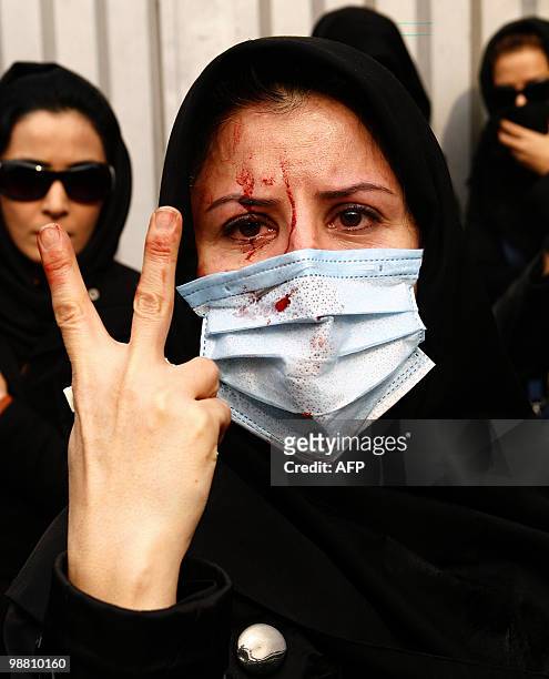 An injured Iranian opposition supporter flashes a V-sign during clashes with security forces in Tehran on December 27, 2009. At least five protesters...