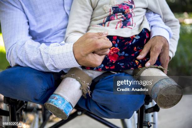 Syrian Maya Meri , who lost her legs during birth and since then started using artificial legs, which were made from pvc pipes and tin cans by her...