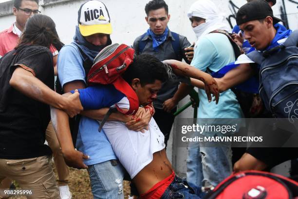 Anti-government protesters help an injured partner during clashes within the "Marcha de las Flores" in Managua, on June 30, 2018. - At least six...