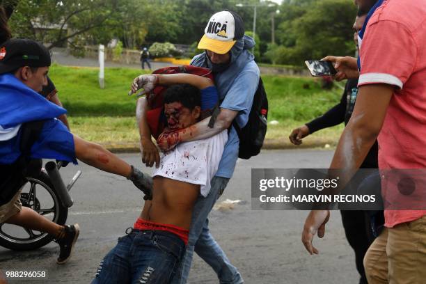 Anti-government protesters help an injured partner during clashes within the "Marcha de las Flores" in Managua, on June 30, 2018. - At least six...