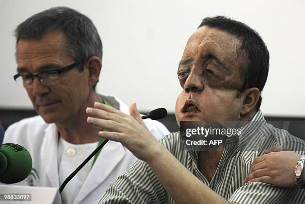 Health-surgery-face-transplant-Spain" Rafael gives a press conference next to doctor Tomas Gomez Cia, head of the plastic surgery unit, after...