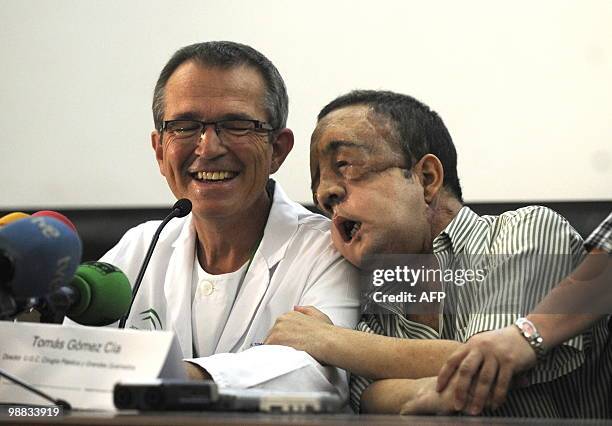 Health-surgery-face-transplant-Spain" Rafael gives a press conference next to doctor Tomas Gomez Cia, head of the plastic surgery unit, after...