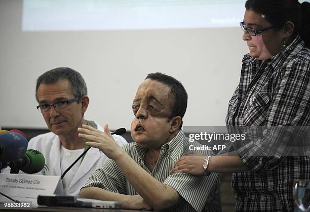 Health-surgery-face-transplant-Spain" Rafael gives a press conference next to doctor Tomas Gomez Cia , head of the plastic surgery unit, after...