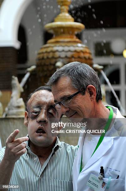 Health-surgery-face-transplant-Spain" Rafael poses with doctor Tomas Gomez Cia , head of the plastic surgery unit, after undergoing a face transplant...