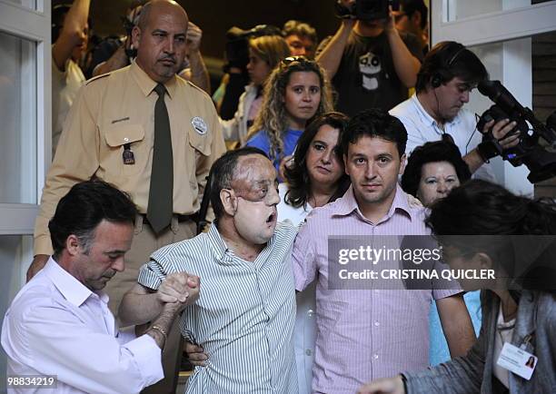 Health-surgery-face-transplant-Spain" Rafael leaves Sevilla's Hospital Virgen del Roci­o on May 4, 2010 in Sevilla after undergoing a face...