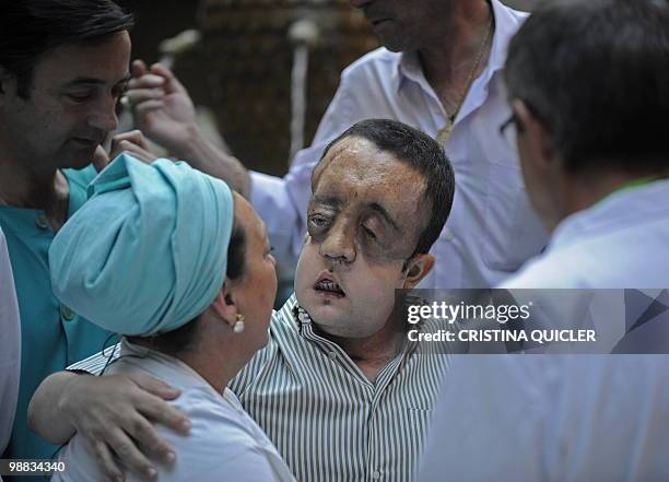 Health-surgery-face-transplant-Spain" Rafael hugs a nurse after undergoing a face transplant at Sevilla's Hospital Virgen del Roci­o on May 4, 2010...