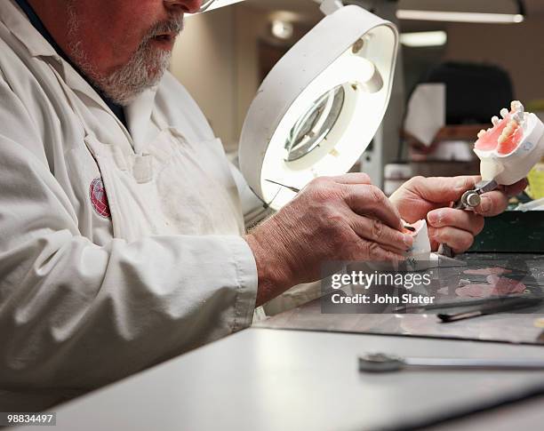 lab technician working on dental impression - dental mould stock pictures, royalty-free photos & images