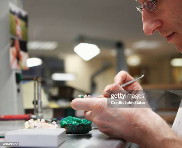 lab technician working on dental casting - dental mould stock pictures, royalty-free photos & images