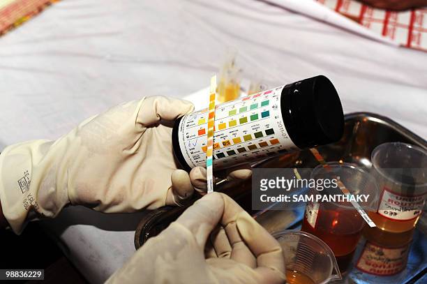 An Indian pathologist examines a urine sample during company's employee health checkup tests in Moraiya some 30 km from Ahmedabad on May 4, 2010....