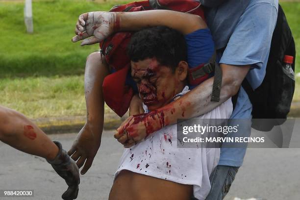 Anti-government protesters help an injured partner during clashes within the "Marcha de las Flores" in Managua, on June 30, 2018. - At least six...