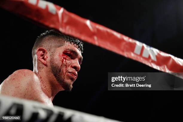Junior welterweight Alex Saucedo looks out into the crowd as he heads to his corner during the fight against Leonardo Zappavigna at Chesapeake Energy...