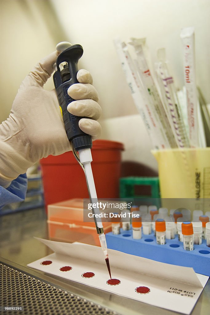 Pipette applying Blood Sample to Paper