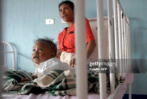 Mother takes care of herson, affected by chronic malnutrition August 27 at the pediatric ward of the hospital of Jalapa, 170 km west of Guatemala...