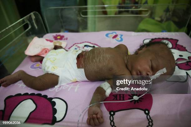 An African migrant baby patient, who will be repatriated to their countries, lies inside of a incubator at Tamanrasset Hospital of the refugee camp...