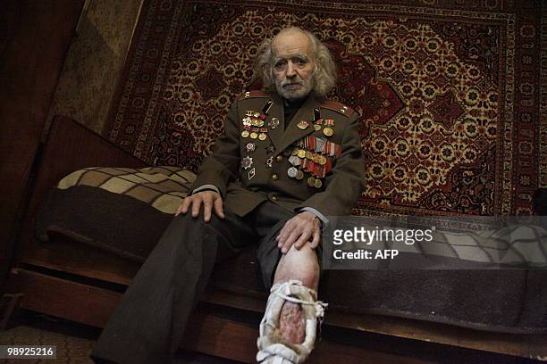 Wounded Soviet Army WWII combat veteran Karlen Ananian sits in his home in Moscow on May 8, 2010. Ananian's left leg was hit by enemy shrapnel in...
