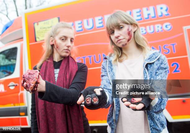 Two young women present fake injuries that could be caused by fireworks during a presentation of the firebrigade on the dangers of wrong usage of...