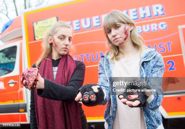 Two young women present fake injuries that could be caused by fireworks during a presentation of the firebrigade on the dangers of wrong usage of...