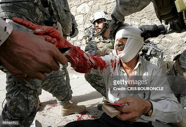 Wounded Iraqi receives medical treatment by US Soldiers from the First Battalion, 17th Infantry after he was injured during an attack carried by...