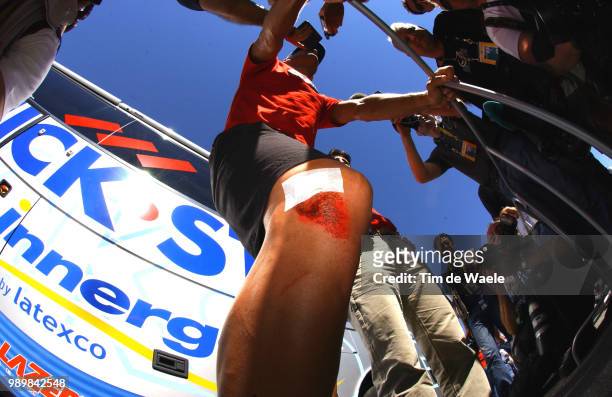 Tour De France 2005, Stage 12 Boonen Tom Knee Injury Blessure Genou Knie Blessure Brianã§On - Digne-Les-Bainsetape Ritronde Van Frankrijk, Tdf, Uci...
