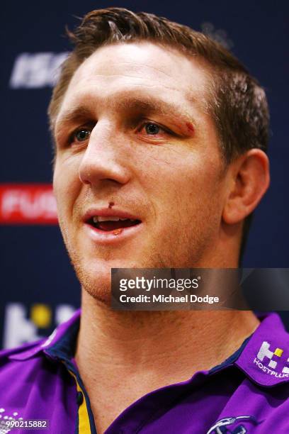 Melbourne Storm veteran Ryan Hoffman speaks to media during a press conference to announce his retirement on July 3, 2018 in Melbourne, Australia....