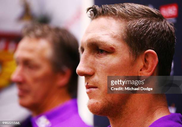Melbourne Storm veteran Ryan Hoffman speaks to media next to head coach Craig Bellamy during a press conference to announce his retirement on July 3,...