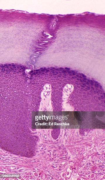 anatomy of thick skin--epidermis, dermis, sweat gland duct, sensory receptors (meissner's corpuscles) 25x - exokrine drüse stock-fotos und bilder