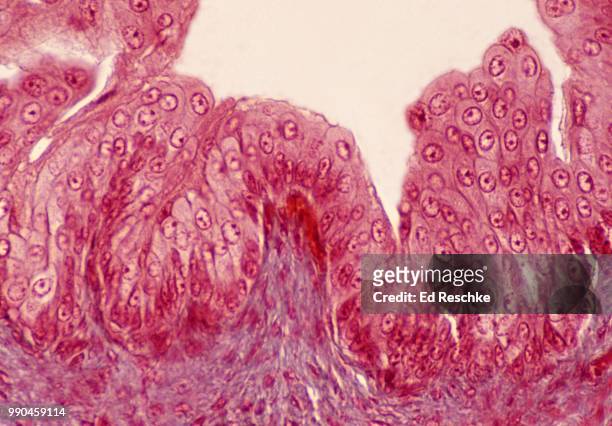 epithelium--transitional epithelium lining the inside of the urinary bladder, 100x - tejido epitelial fotografías e imágenes de stock
