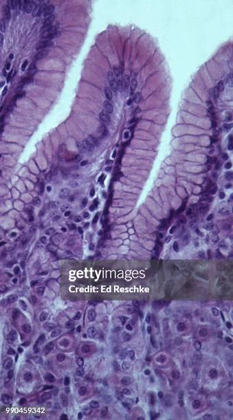 stomach--epithelial lining showing gastric glands, including gastric pits, parietal cells and chief cells, 100x - parietal cell stockfoto's en -beelden