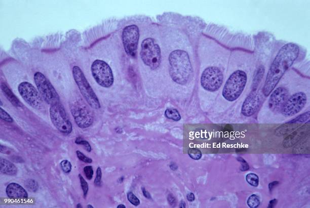 ciliated simple columnar epithelium lining the uterine tubes (fallopian tubes or oviducts) human, 250x - simple columnar epithelial cell ストックフォトと画像