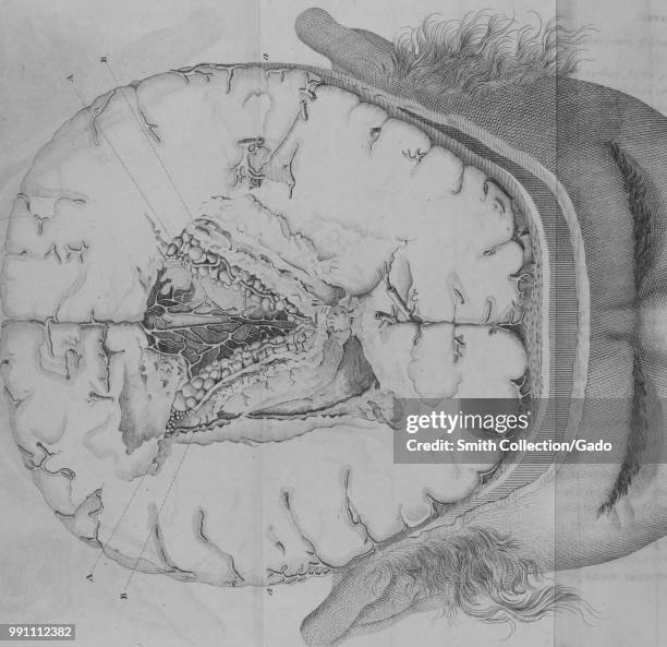 Black and white print illustrating a cross-section of the lateral ventricles of a human brain, with alphabetized figures indicating the sites of...