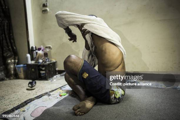 Haider showing a scar from a kidney surgery in Cairo, Egypt, 04 August 2017. The Sudanese man sold a kidney to organ traffickers according to his own...