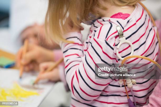 The heart patient Nina draws during a press conference in the Hannover Medical School, Germany, 22 November 2017. Four-year-old Nina was born with a...