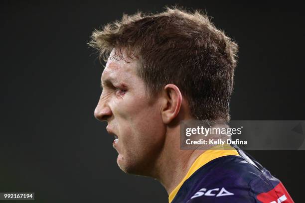 Ryan Hoffman of the Storm is seen with a cut to his eye during the round 17 NRL match between the Melbourne Storm and the St George Illawarra Dragons...