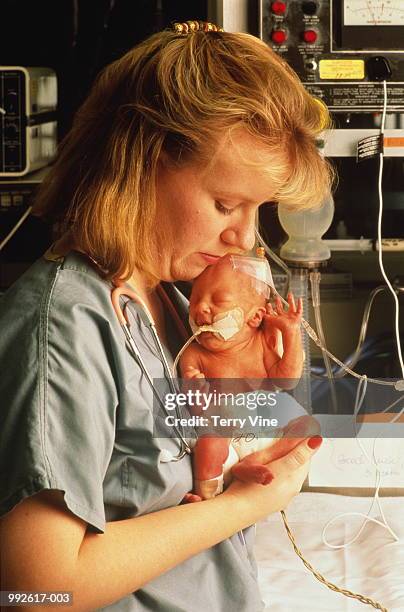 nurse with infant in neonatal intensive care unit - premature baby incubator fotografías e imágenes de stock