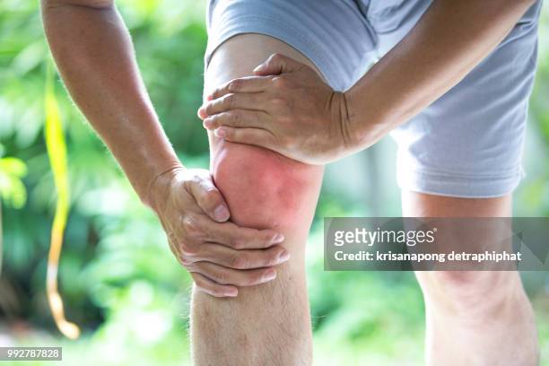 knee ache,businessman knee pain - arthritis stock-fotos und bilder