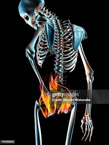 the ache of the body - newhealth stock-fotos und bilder