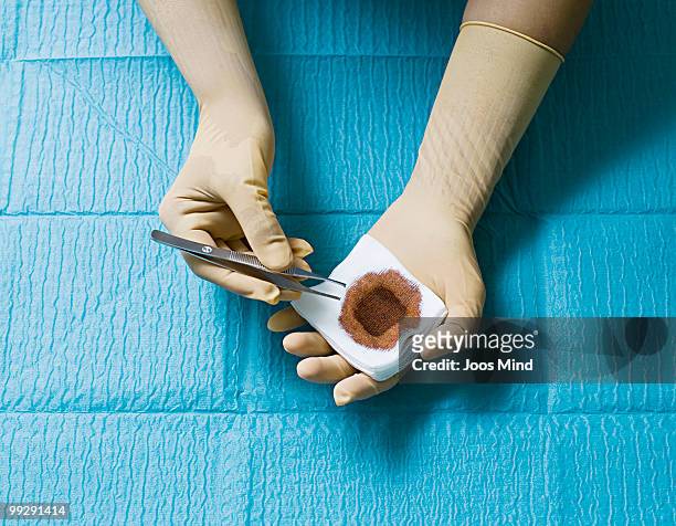 doctor wearing surgical gloves holding gauze swab - newhealth stock pictures, royalty-free photos & images