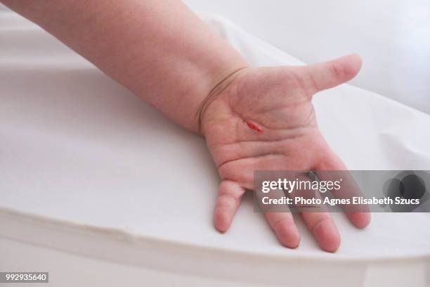 Hand Incision Cut 966 Cut (Wound) Stock Photos, High-Res Pictures, and Images - Getty Images