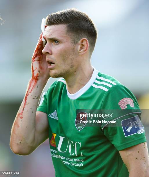 Cork , Ireland - 6 July 2018; Garry Buckley of Cork City holds his head after being injured during the SSE Airtricity League Premier Division match...