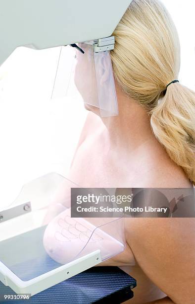 mammography - mammogram stockfoto's en -beelden