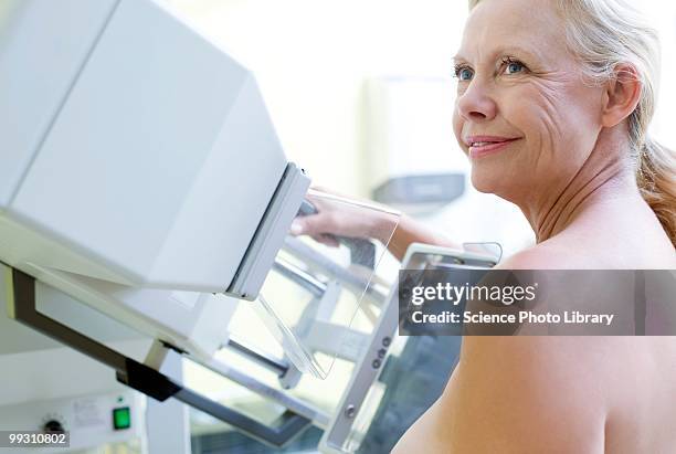 mammography - mammographie stock-fotos und bilder