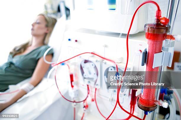 kidney dialysis - dialysis stock-fotos und bilder