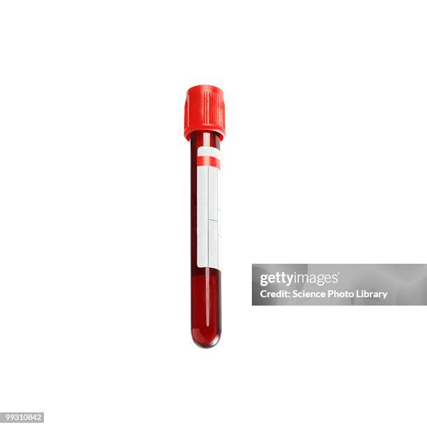 blood sample - medicinflaska bildbanksfoton och bilder