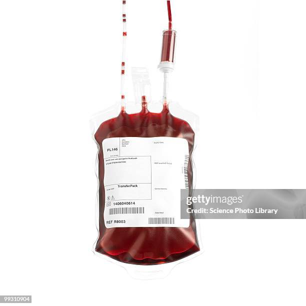 donated blood - blood bag foto e immagini stock