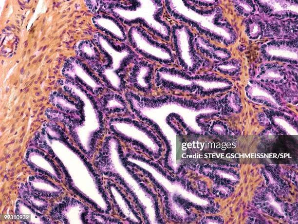 seminal vesicle, light micrograph - lamina propria fotografías e imágenes de stock