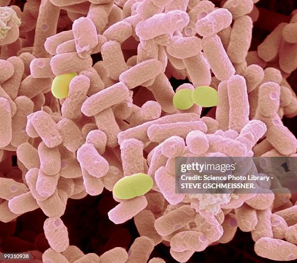 e. coli bacteria, sem - micrografía electrónica escaneadora fotografías e imágenes de stock