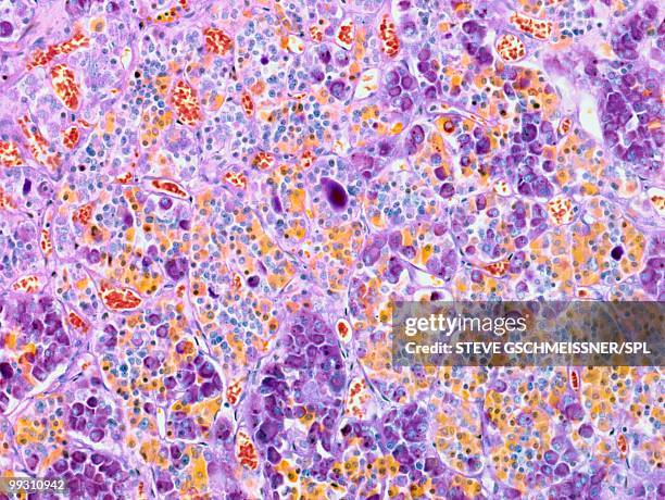 pituitary gland, light micrograph - organismo acidófilo imagens e fotografias de stock