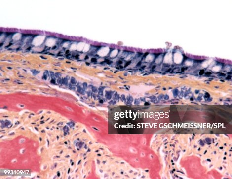 Nasal lining, light micrograph Nasal lining, light micrograph